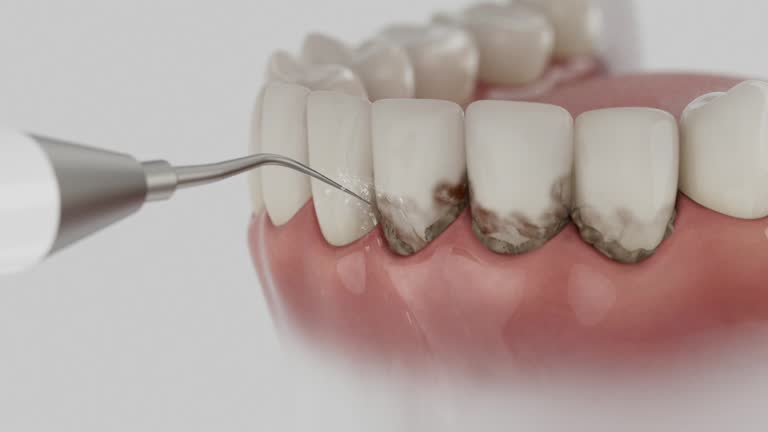 Reliable Dental Implants contractor in Ripley, TN by Smile Center Dentistry